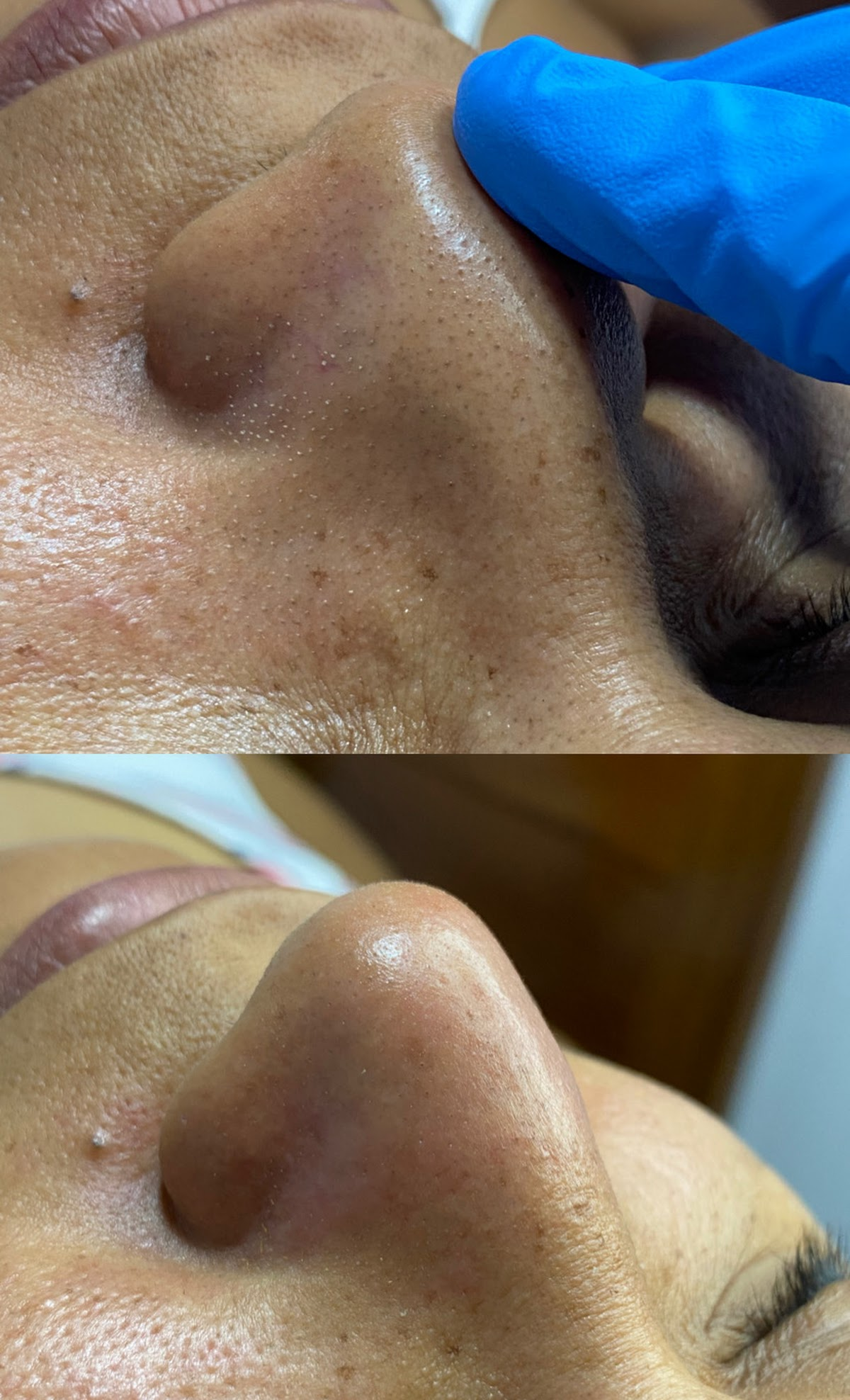 Skin Care Personalizado